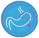 http://www.antiobesitycenter.com/wp-content/uploads/2018/07/lapband.png